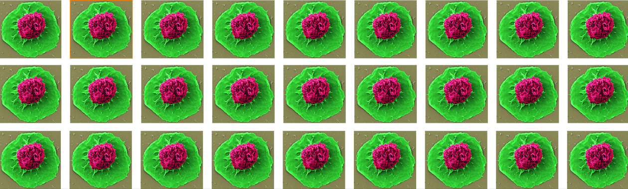 monocyte_EM
